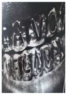 Fig. 3.